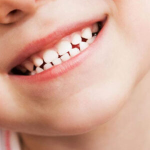 دندان شیری کودکان