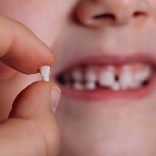 دندان شیری کودکان