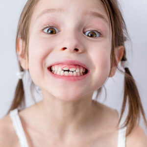 دندان شیری کودکان