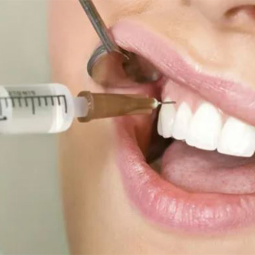 دندانپزشکی با بی حسی قوی