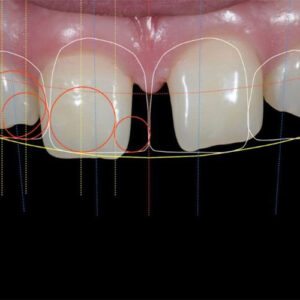 طراحی لبخند دیجیتال