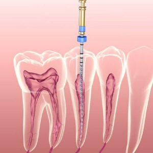 اندودنتیست