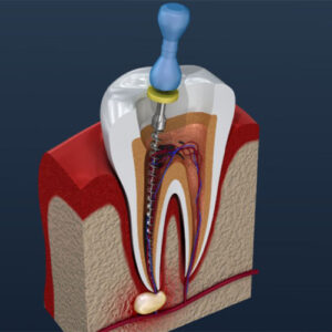 اندودنتیست