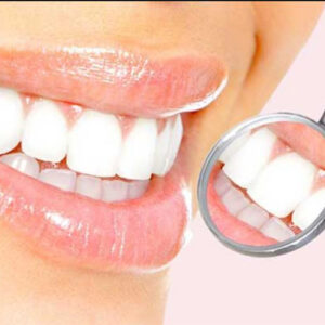 تفاوت لمینت و کامپوزیت