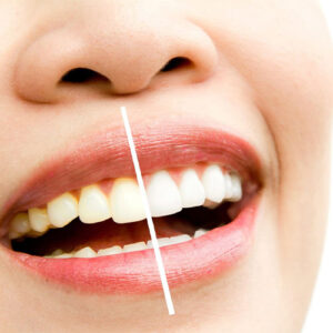 تفاوت لمینت و کامپوزیت