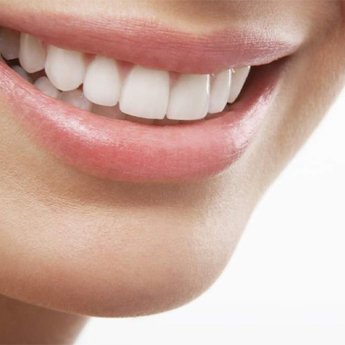 تفاوت لمینت و کامپوزیت