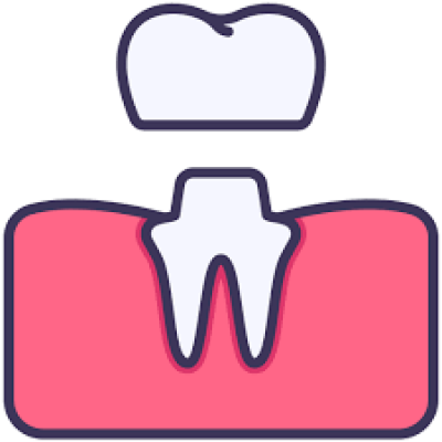 Dental crown Dental crown