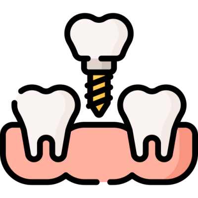 Dental prosthesis Dental prosthesis