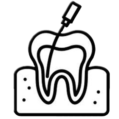 Nerve removal Nerve removal